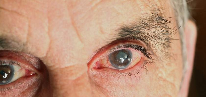 Реабилитация для пожилых после лечения болезней глаз фото